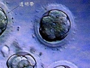 龙岩市第一医院做试管婴儿怎么样？内附试管价格表参考